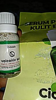 Product Review of Volcanic Ash Pimple Drying Lotion 20ml - PIMPLE SPOT VOLCANIC ASH- OBAT TOTOL JERAWAT from a** I**? 1