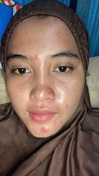 Product Review of KBILEEYS PAKET MILENIAL UNTUK KULIT NORMAL,BERFLEK Mencerahkan Wajah from A**_ 0