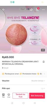 Product Review of MARWAH TELANGYN CREAM/KRIM URAT/BPOM/HALAL/ORIGINAL from R**T 0