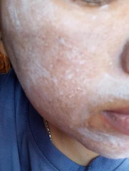 Product Review of ( Ready Stock ) Byzoe Face Peeling Mask Dead Cell Remover - FYC from l**5 2