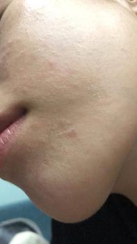 Product Review of (Quà tặng 1 Nước tẩy trang 30ml)Kem chống nắng thuần vật lý cho da nhạy cảm Dr.G Green Mild Up Sun+ SPF50+ PA++++ 50ml from T**i 1