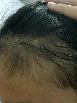 Product Review of (BPOM) CATTRA OIL by Cattleyaradista | (before: minyak alis herbal) new name & packaging from V**a 1