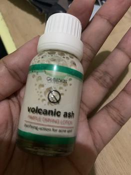 Product Review of Volcanic Ash Pimple Drying Lotion 20ml - PIMPLE SPOT VOLCANIC ASH- OBAT TOTOL JERAWAT from ** 1